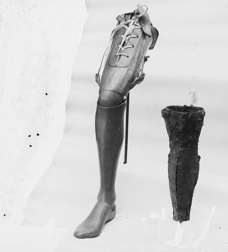 Illustration for article titled The History of Prosthetics Reveals a Long Tradition of Human Cyborgs